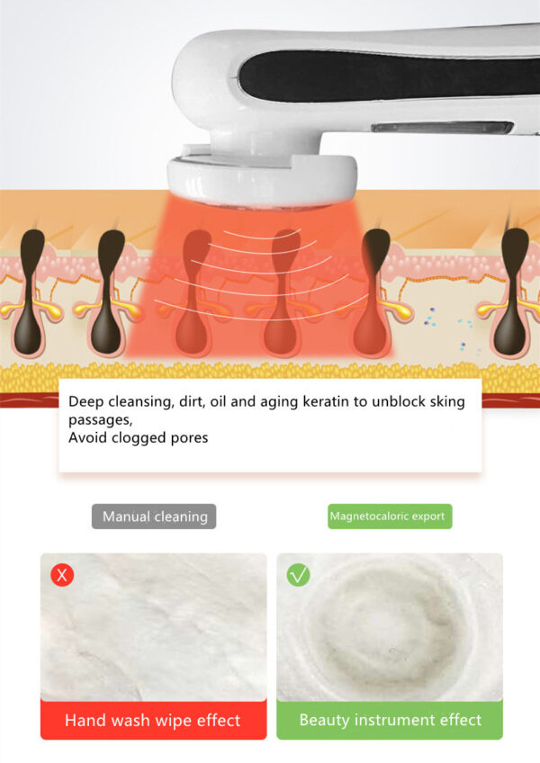 New Iontophoresis Personal Care Negative Iontophoresis Beauty Equipment - Image 3